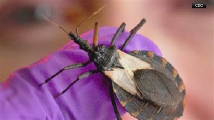 Can a bug go to your brain?