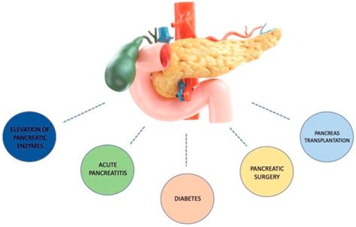 Can Covid affect your pancreas?