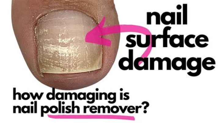 Can leaving nail polish on too long damage nails?