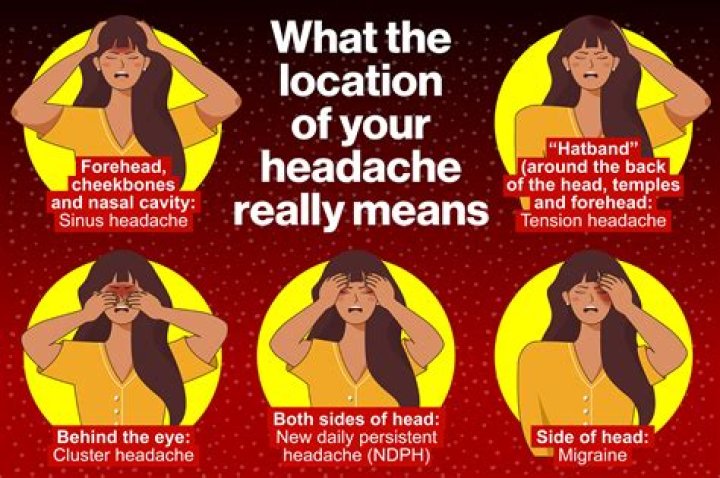 Can rice give you headaches?