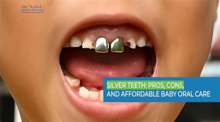 Can silver teeth be removed?