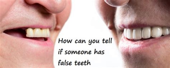 Can you tell if someone has false teeth?