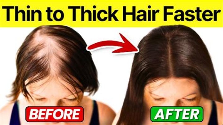 Do wigs stop hair from growing?