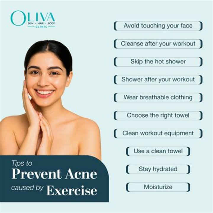 Does exercise clear acne?
