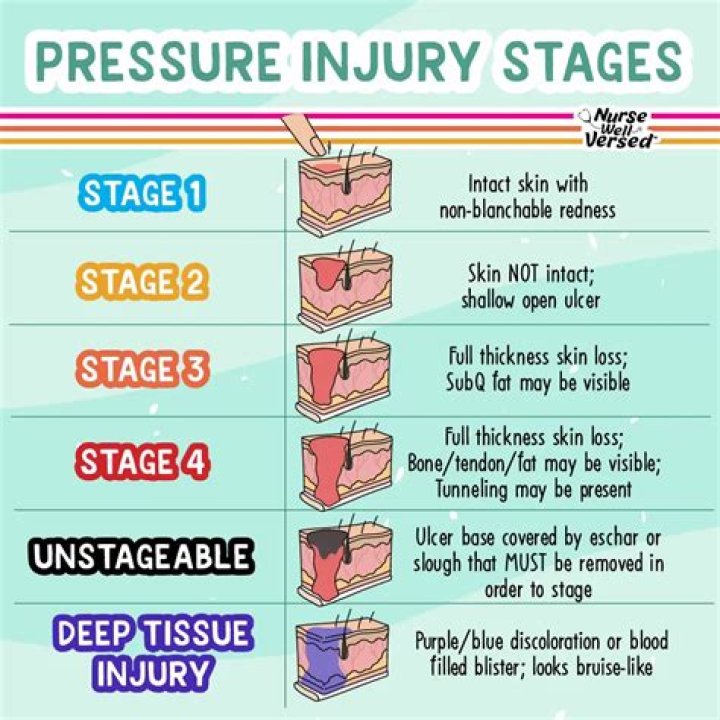 What are the 3 stages in sale?