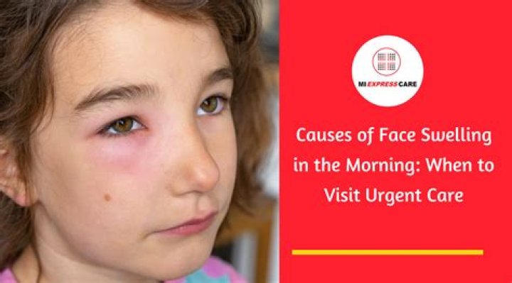 What causes swollen cheeks?