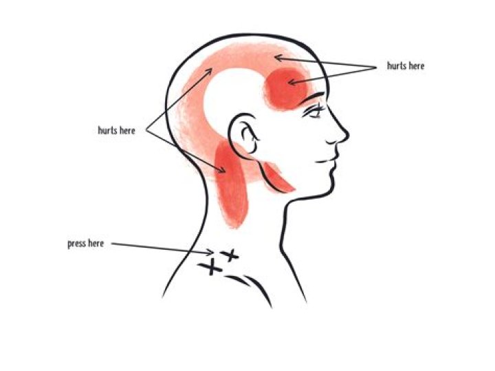 What does a headache in the back of the head indicate?
