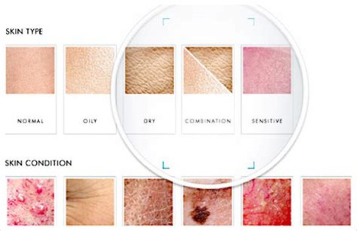 What does skin breakdown look like?