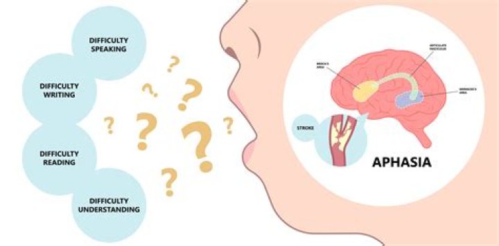 What is alexia aphasia?
