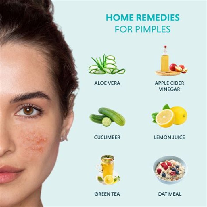What is good for teenage pimples?