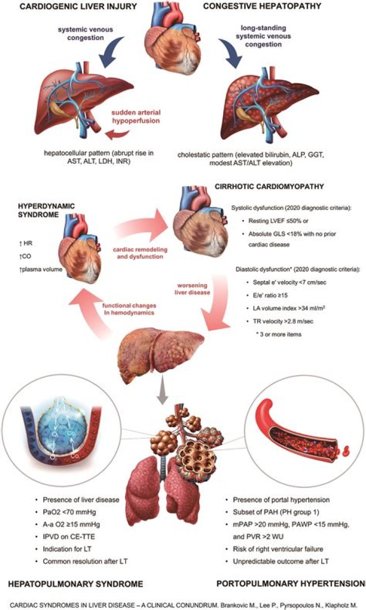 What is the most common cause of congestive splenomegaly?