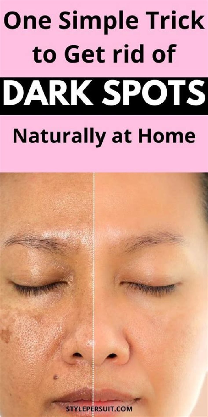 What oils lighten dark spots?