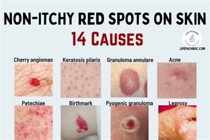What to put on a rash that itches?