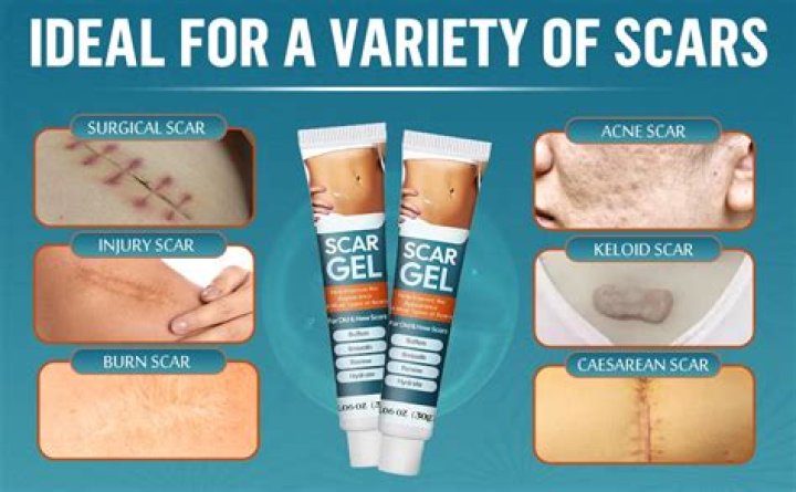 When can you start using scar cream after surgery?