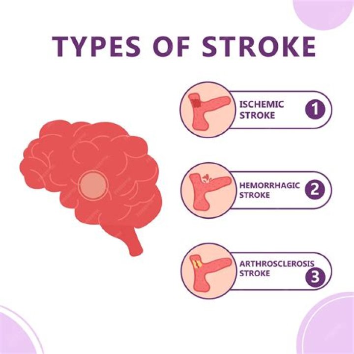 Which type of stroke is worse?