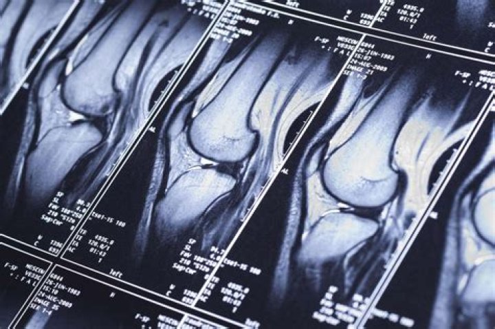 Why do you need MRI dye?