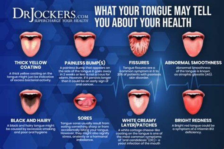 Why does the back of my tongue feel like sandpaper?